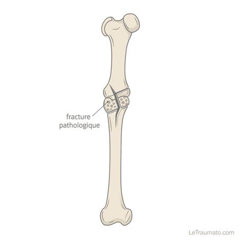 La fracture oubliée : Pourquoi l’Europe ne peut pas guérir sans comprendre son passé